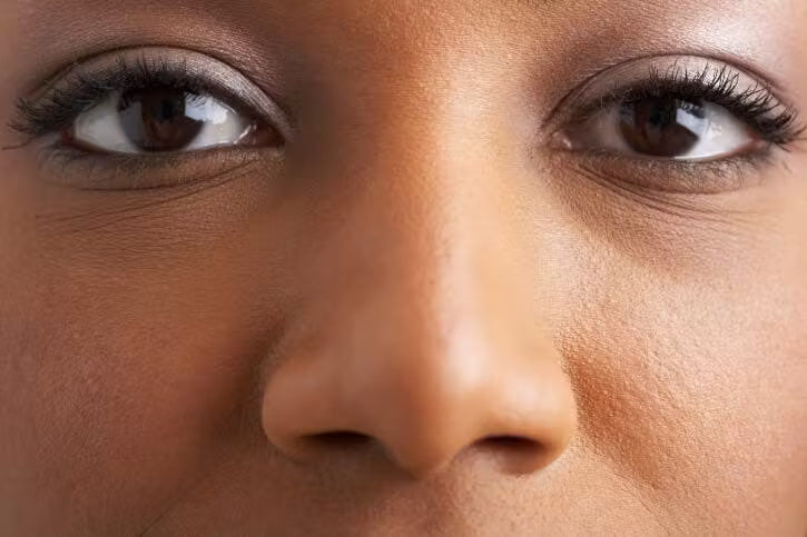 Laser Hair Removal — Nose - Course of 6 treatments